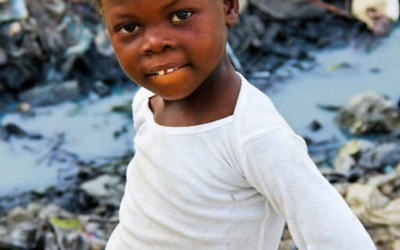Child resident of landfill. Many children already grow up with various diseases when they are exposed to litter, untreated water and precarious food. The cause for the stomach belly, like that of the girl, can be malnutrition and worms. Port-Au-Prince, Haiti, 2012.